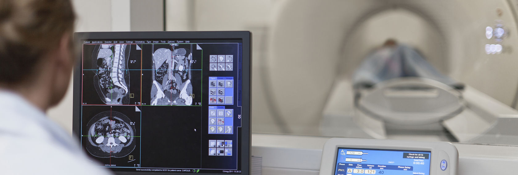 Doctor looking at CT Scan